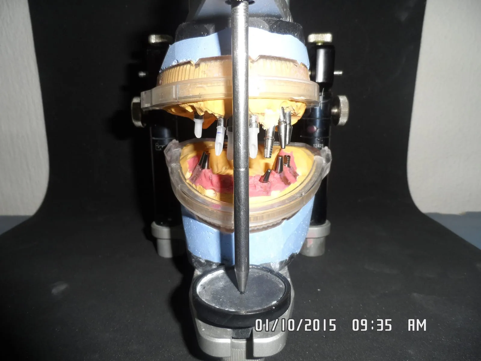 Implant-supported
