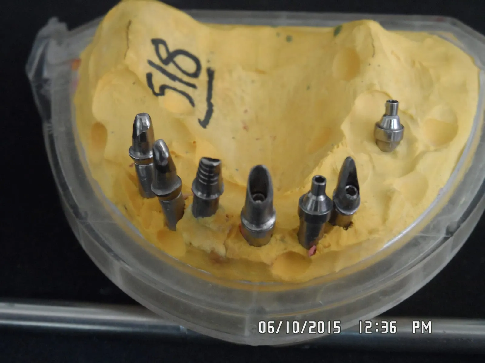 Implant-supported