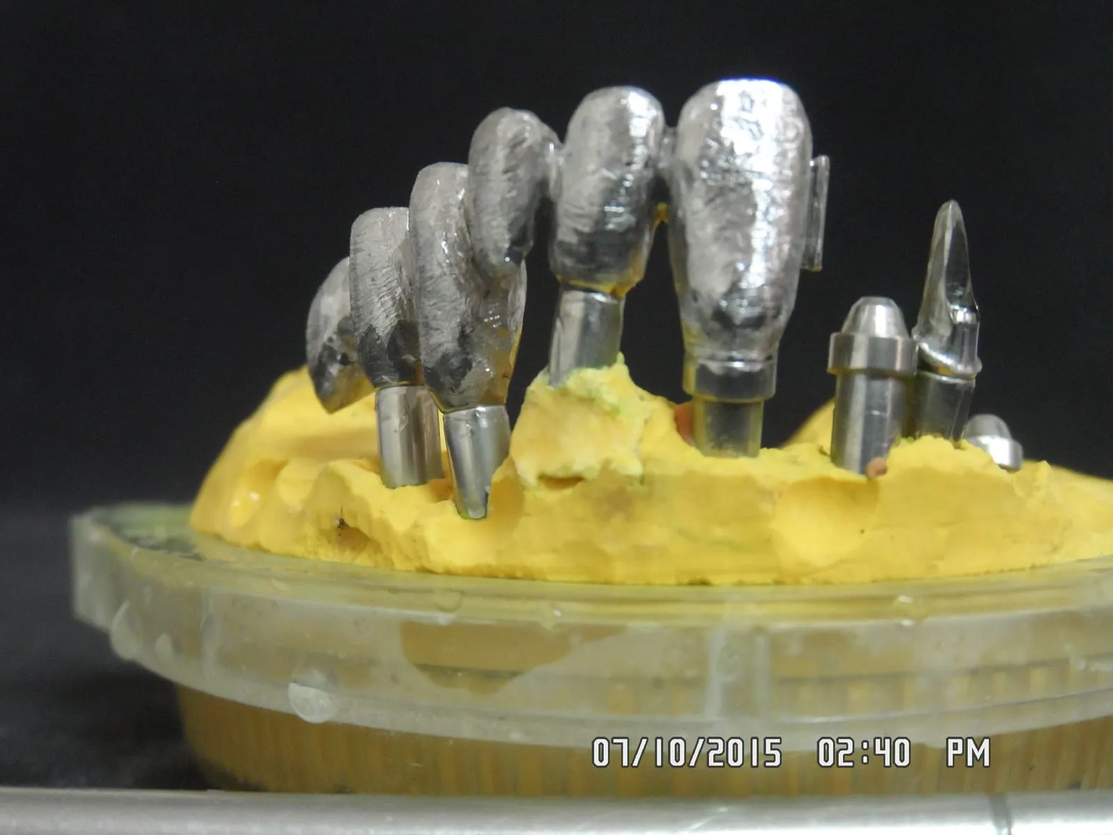 Implant-supported