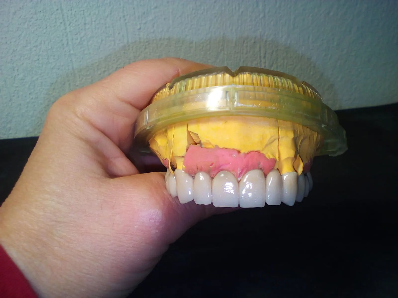 Metal-ceramic