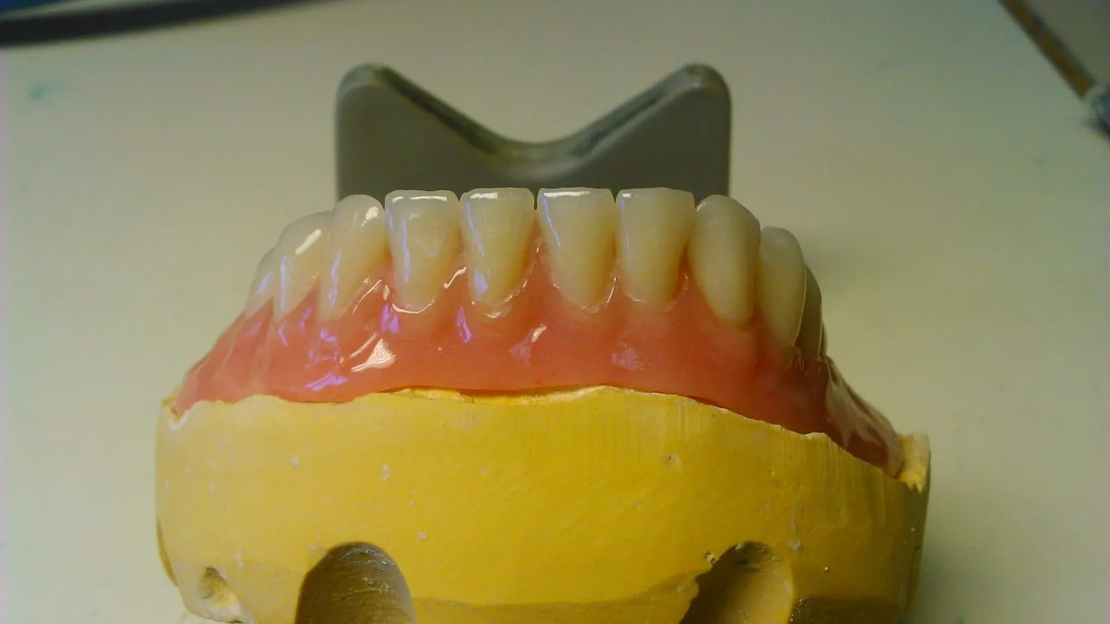 Removable