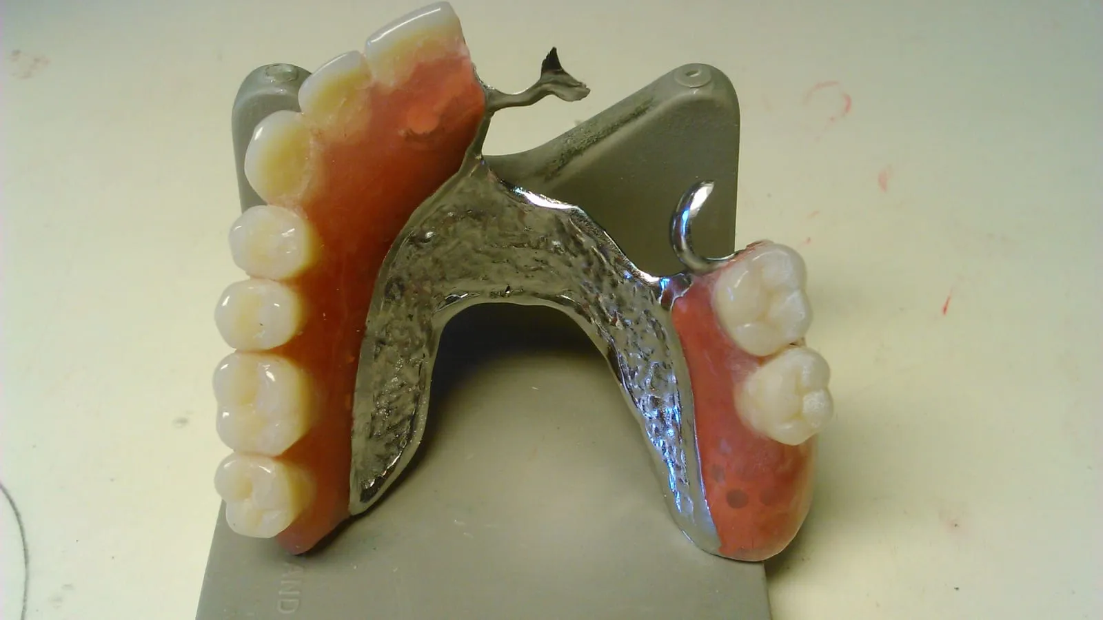 Removable