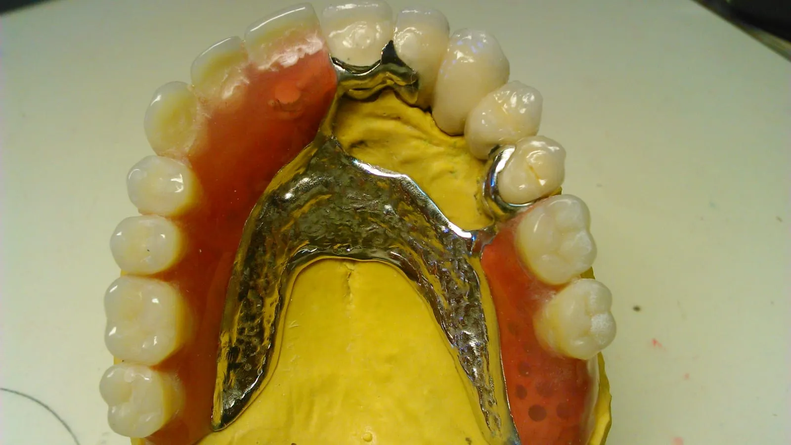 Removable