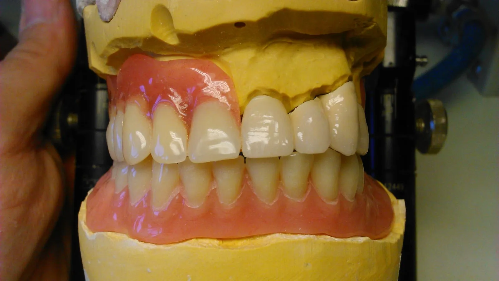 Removable