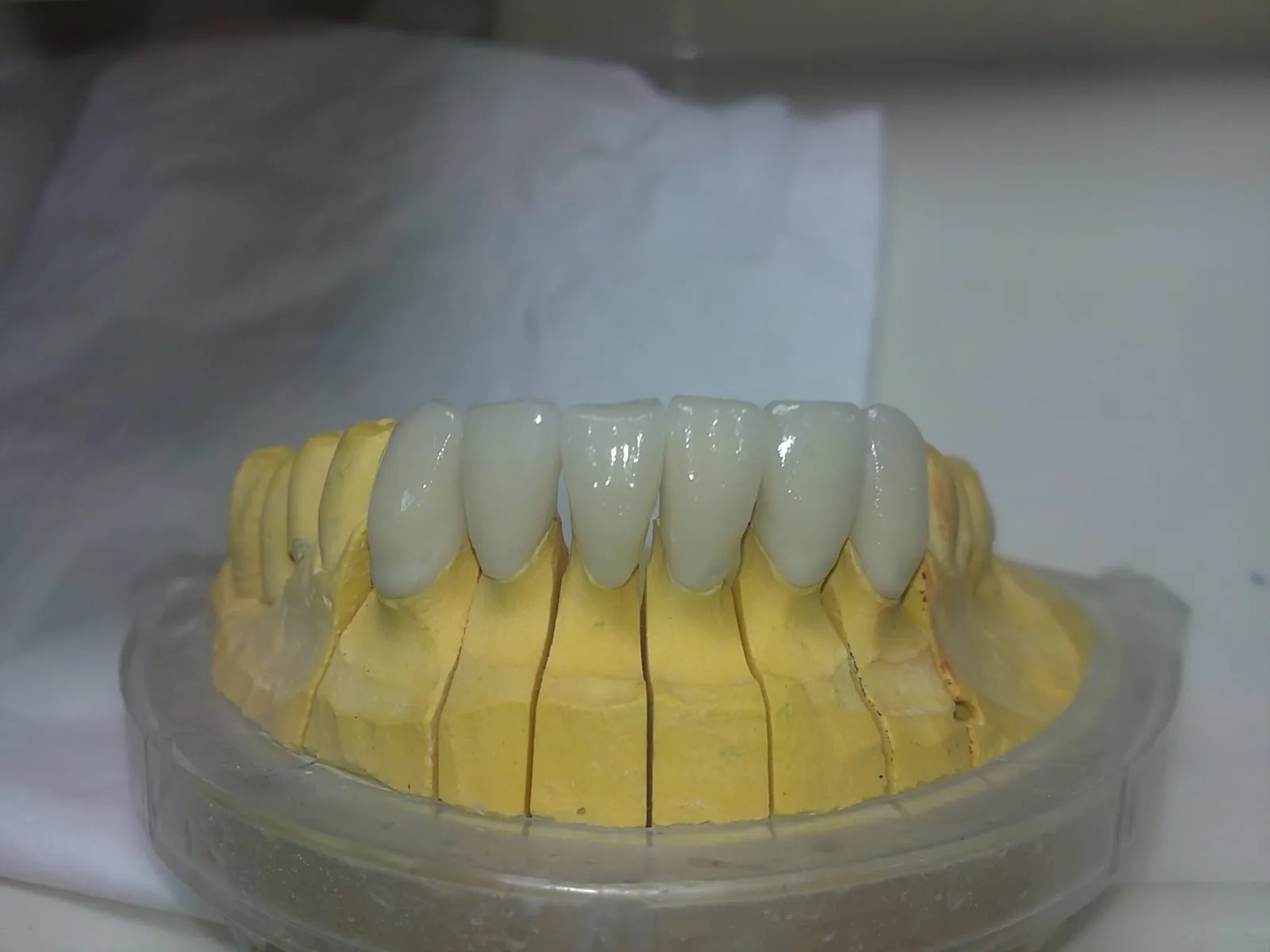Zirconia