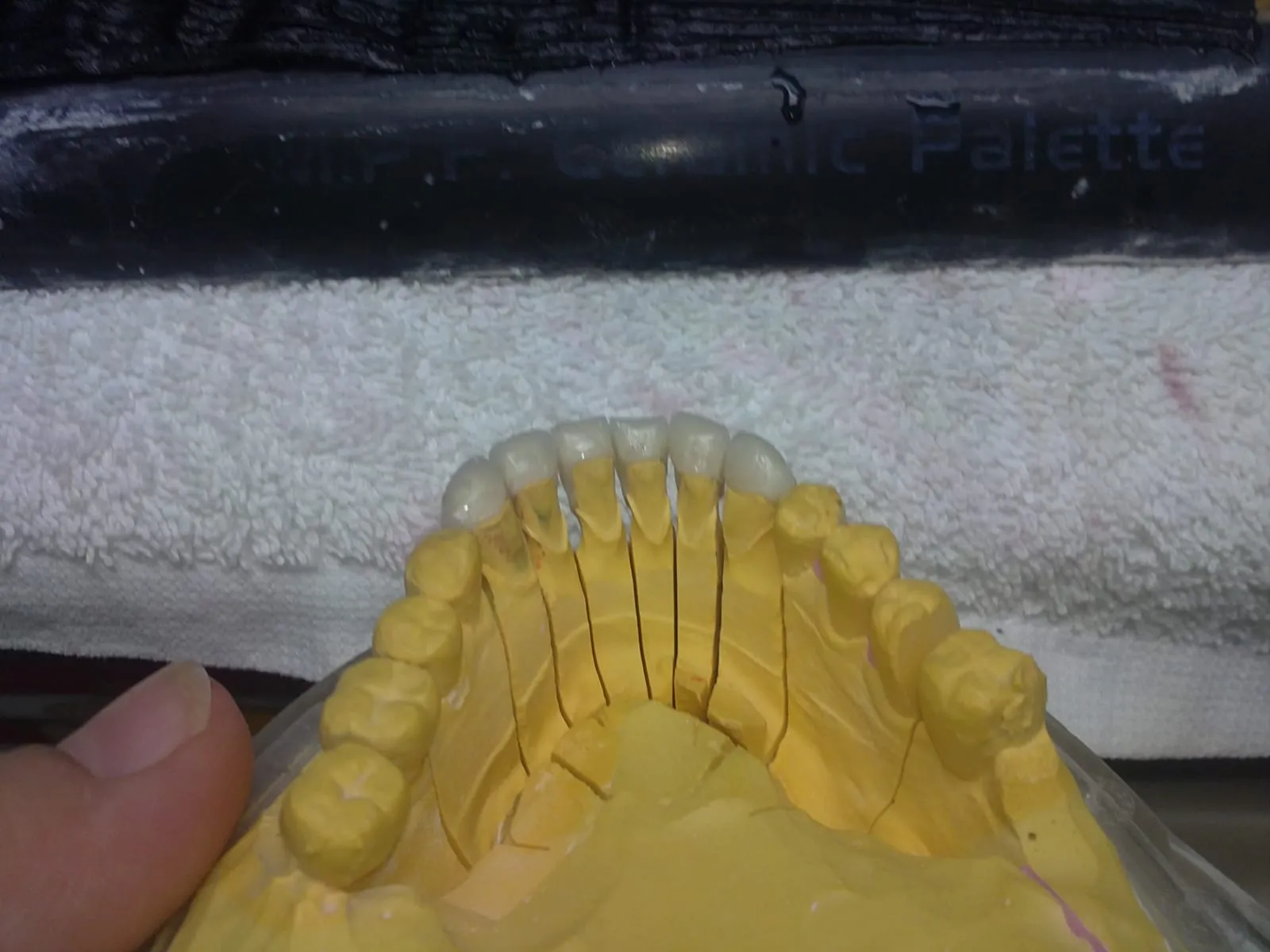 Zirconia