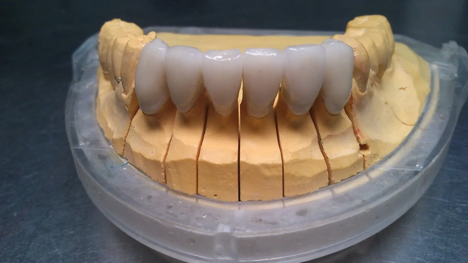 Zirconia